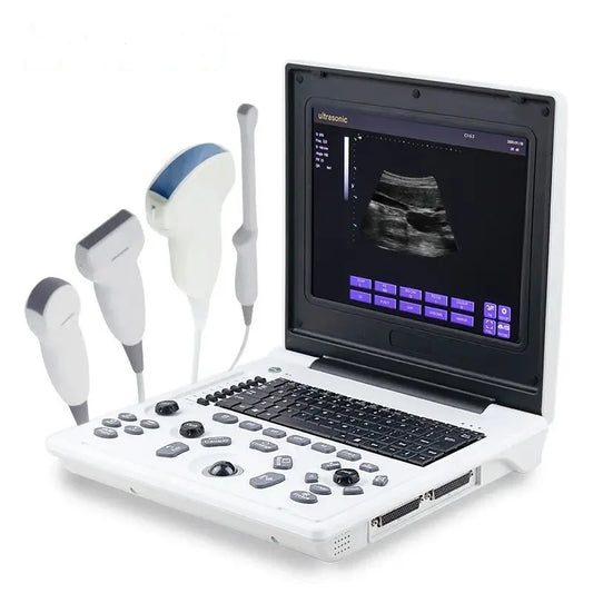 digital echocardiography instruments sonography ultrasonography laptop black and white portable medical ultrasound Scanner USG